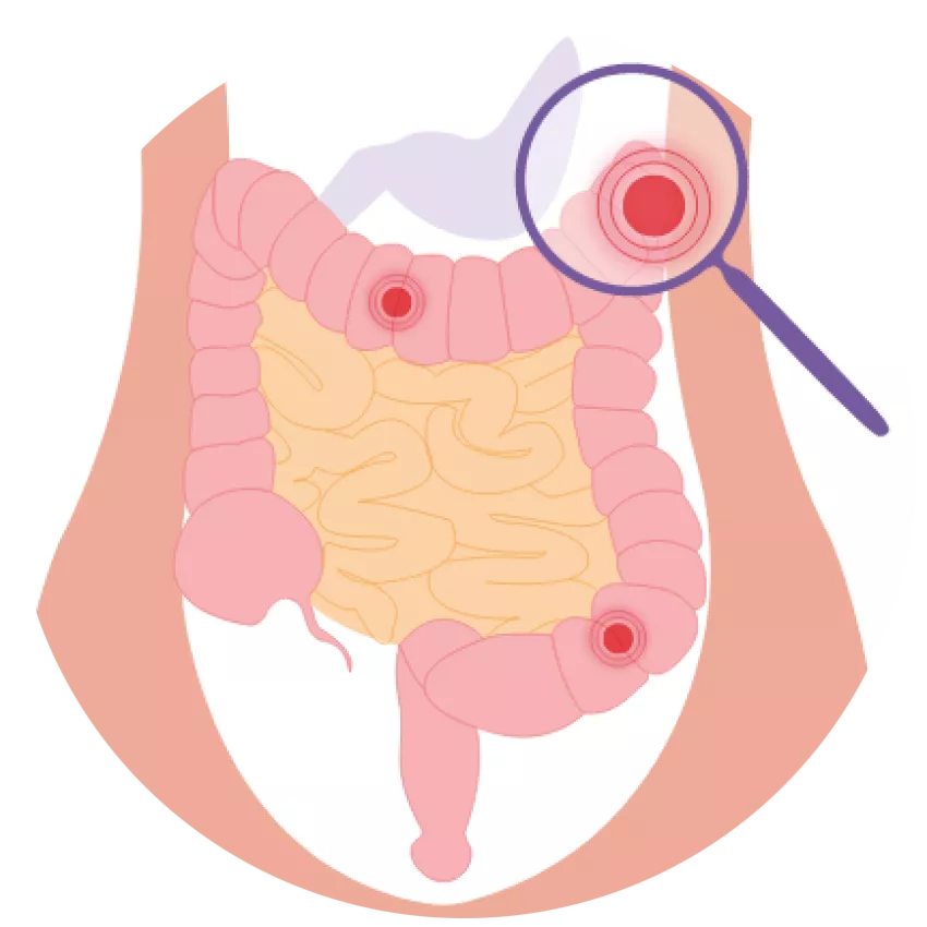 What is the aim of the study